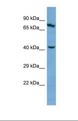 Polyclonal Rabbit anti-Human KRT83 / Keratin 83 / KRTHB3 Antibody (aa201-250, WB)