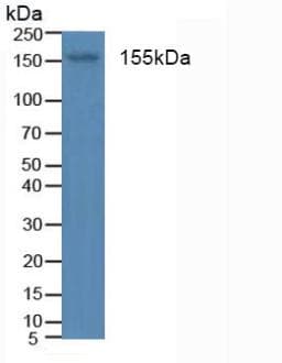 INSR / Insulin Receptor Antibody (aa1024-1298, FITC)