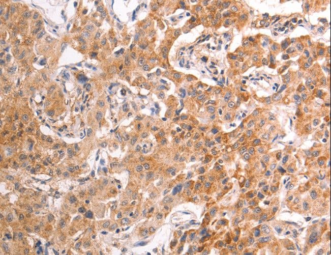 TRPV4 Antibody