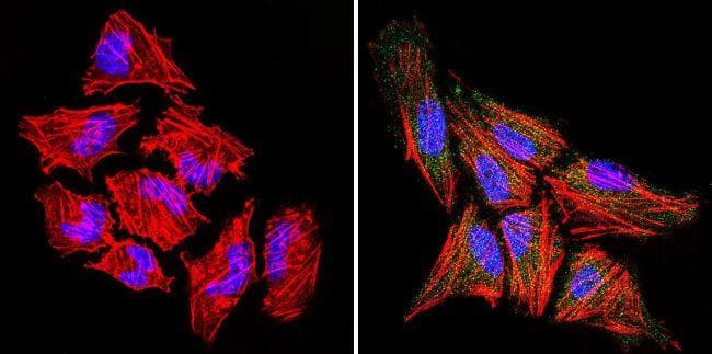 Polyclonal Goat Anti-Rabbit IgG Secondary Antibody (DY488, IHC, IF, WB)