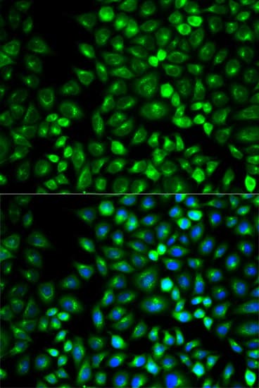 GRM3 / MGLUR3 Antibody