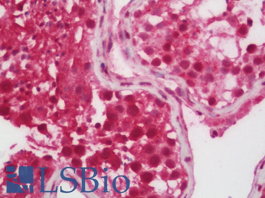 IHC-plus™ SETD2 Antibody