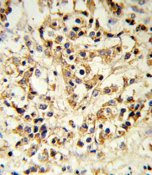 FGFR1 / FGF Receptor 1 Antibody