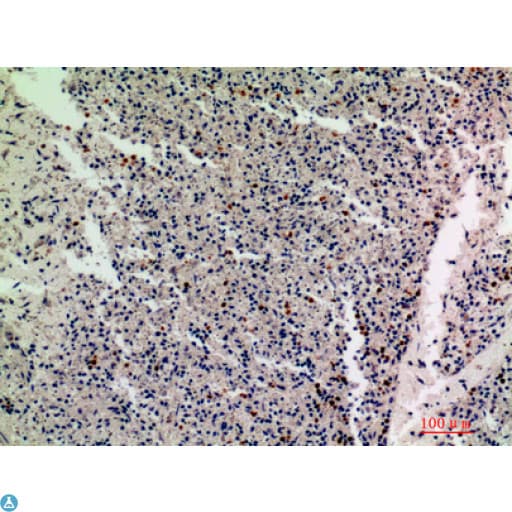 Polyclonal Rabbit anti-Human IL1F10 Antibody (IHC, WB)