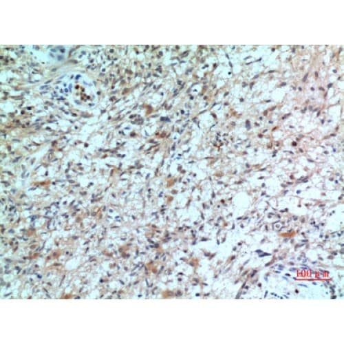 CXCR2 Antibody (1-50 aa, N-terminal)