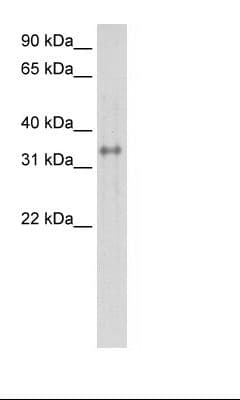 Polyclonal Rabbit anti-Human CA4 / Carbonic Anhydrase IV Antibody (C-Terminus, IHC, WB)