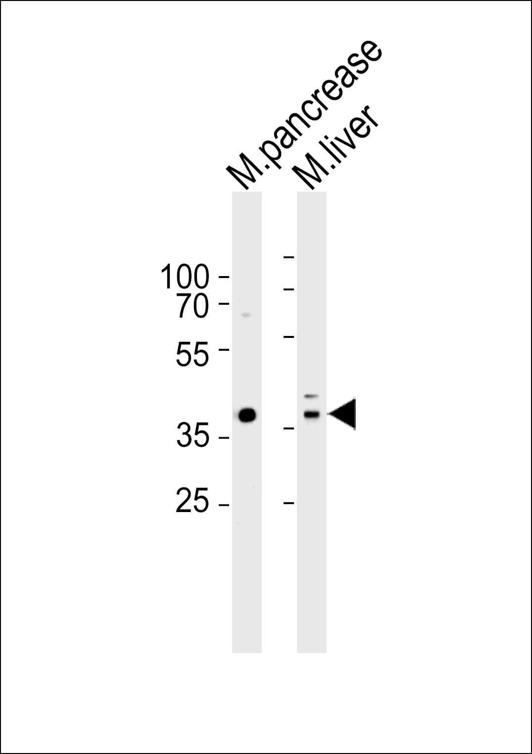 IHC-plus™ HMX3 Antibody (aa193-224)