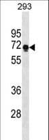 Polyclonal Rabbit anti-Human PRR14 Antibody (aa422-450, WB)