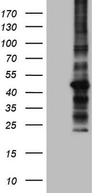 Monoclonal Mouse anti-Human MTOR Antibody (clone OTI4A7, Carrier-free, aa1766-2144, IHC, WB)