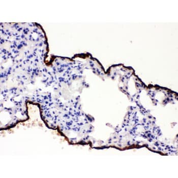 MSLN / Mesothelin Antibody (aa308-576)