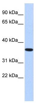 Polyclonal Rabbit anti-Human CPXCR1 / CT77 Antibody (aa396-445, IHC, WB)