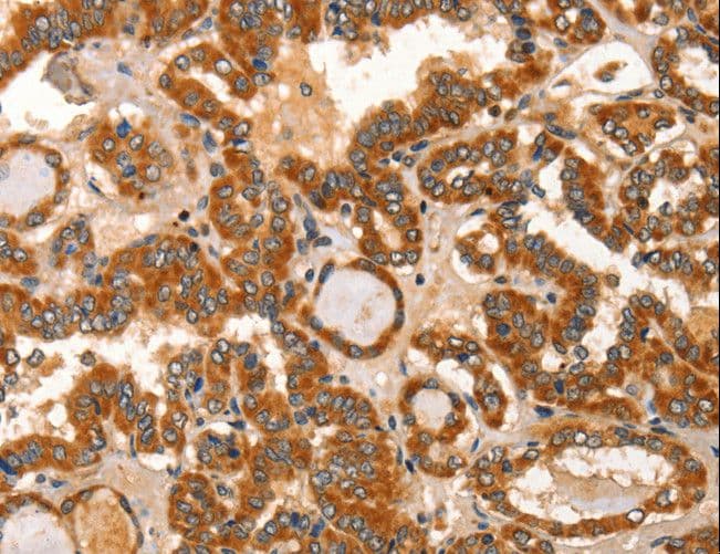 Polyclonal Rabbit anti-Human IKZF3 / AIOLOS Antibody (IHC)