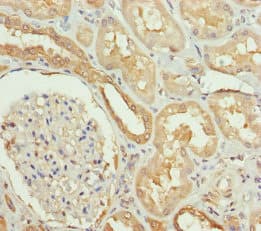 SLC34A1 / NPT2 Antibody