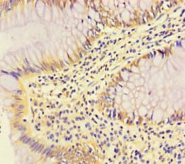 RABEP2 Antibody