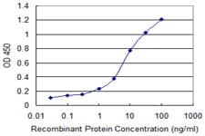 GOT2 Antibody (clone 4H8)