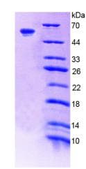 Rat F11 / FXI / Factor XI Protein (Recombinant His-GST)