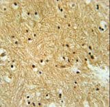 Polyclonal Rabbit anti-Human IPO9 / Importin 9 Antibody (aa79-106, IHC, WB)