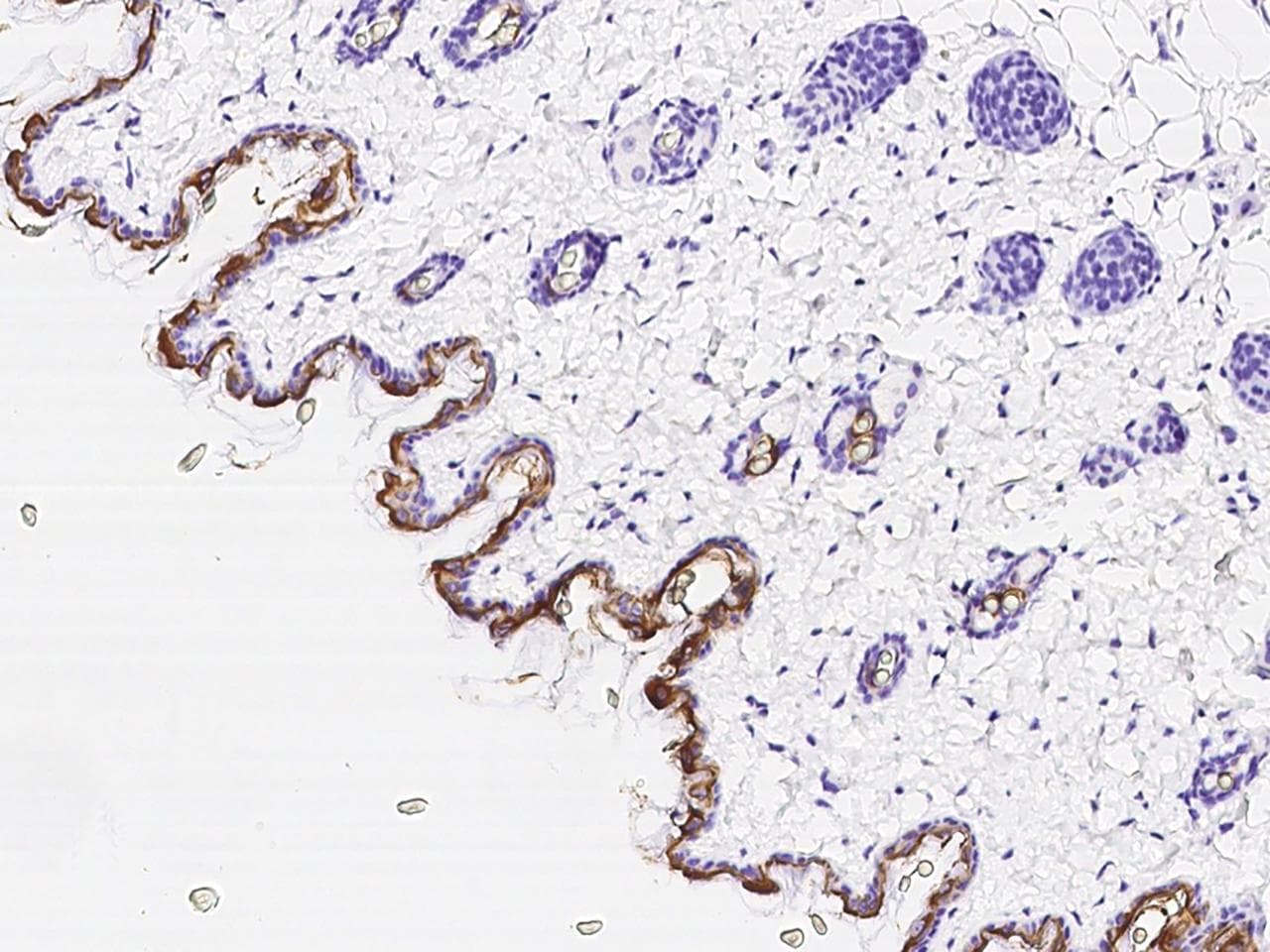 KRT10 / CK10 / Cytokeratin 10 Antibody