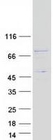 Human C17orf53 Protein (Recombinant Myc-DDK (Flag))