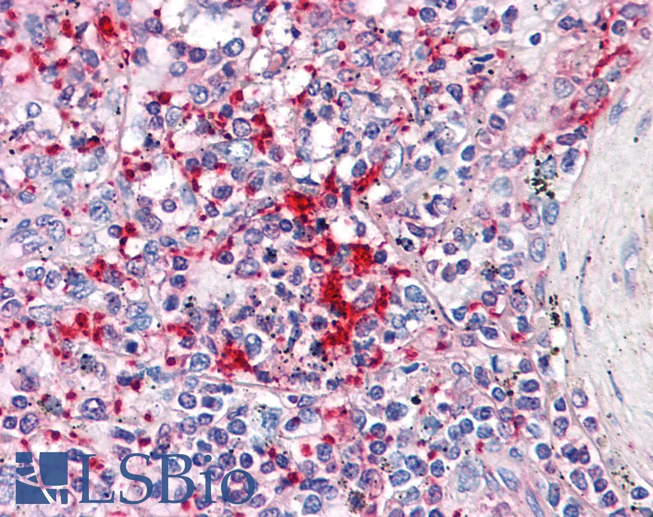 IHC-plus™ Monoclonal Mouse anti-Human TLN1 / Talin 1 Antibody (clone 5C1, IHC, WB)