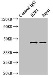 Polyclonal Rabbit anti-Human E2F1 Antibody (IHC, WB)