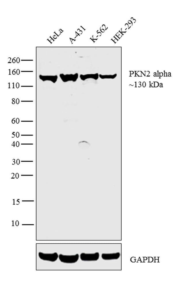 PKN2 Antibody (clone 1D1)