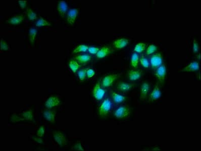 Polyclonal Rabbit anti-Human CFLAR / FLIP Antibody (IHC, WB)
