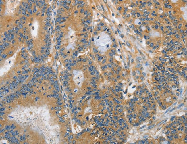 DGKZ Antibody
