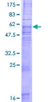 Human CCR8 / CD198 Protein (Recombinant GST)