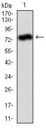 Monoclonal Mouse anti-Human ALPL / Alkaline Phosphatase Antibody (clone 2F4, IHC, WB)