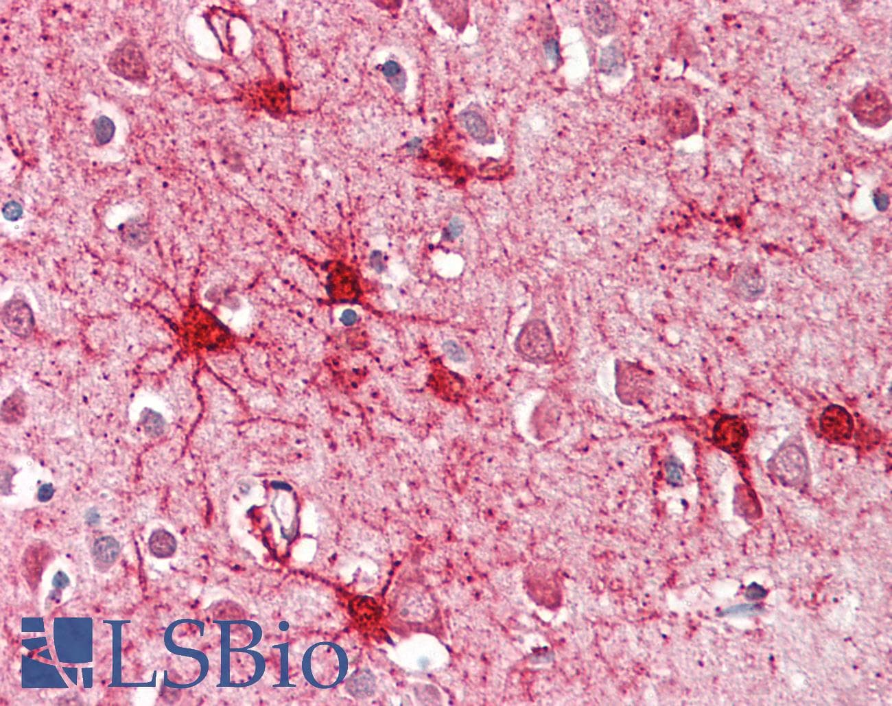 IHC-plus™ GLUD1/Glutamate Dehydrogenase Antibody (aa93-107)