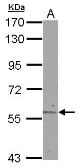 Polyclonal Rabbit anti-Human ALDH6A1 Antibody (IHC, WB)