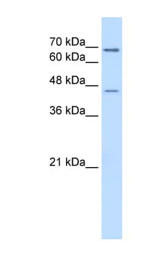 ALDH3A2 Antibody (aa351-400)