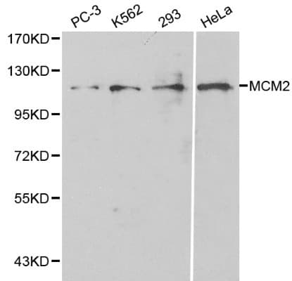 MCM2 Antibody