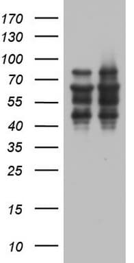 ZNF34 Antibody (aa117-405, clone OTI3G2, Carrier-free)