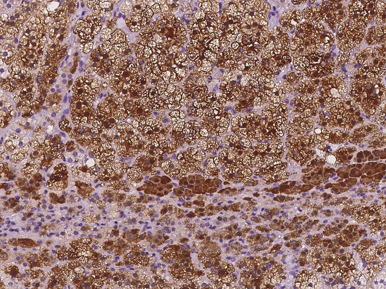 GSTA1 Antibody