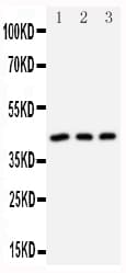Polyclonal Rabbit anti-Human DAPK2 / DAP Kinase 2 Antibody (aa289-308, WB)
