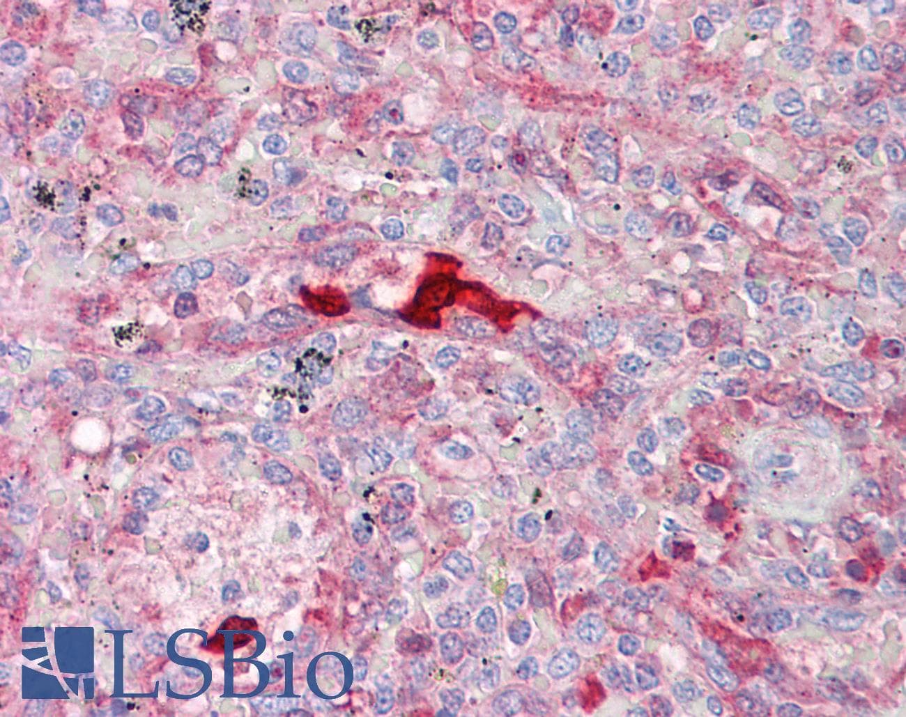 IHC-plus™ Polyclonal Rabbit anti-Human CA1 / Carbonic Anhydrase I Antibody (aa41-90, IHC, WB)