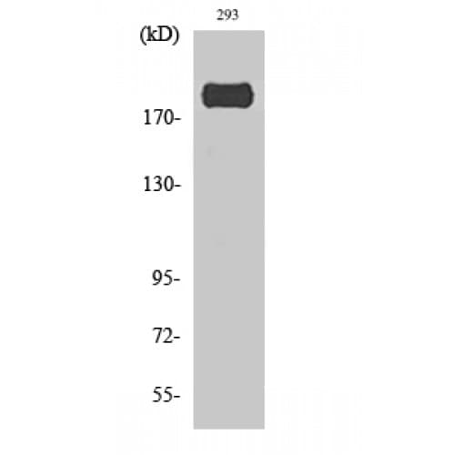 Polyclonal Rabbit anti-Human IRS1 Antibody (250-330 aa, IHC, WB)