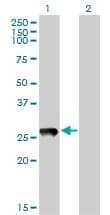 PRELID1 Antibody (clone 7B4)