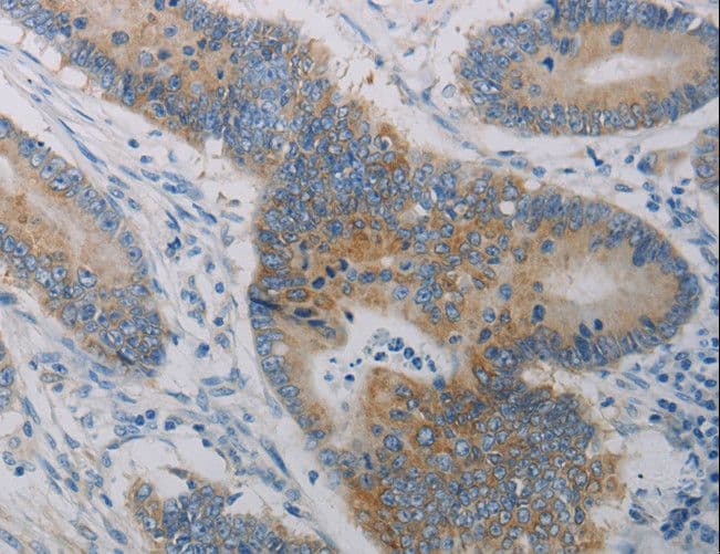 CLEC4C / CD303 / BDCA-2 Antibody