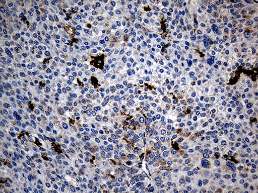 PTPN22 / PEP Antibody (aa359-449, clone OTI6B1)