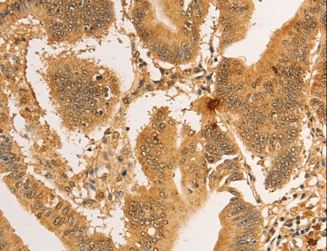 Polyclonal Rabbit anti-Human RPL26L1 Antibody (IHC)