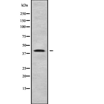 B4GALT4 Antibody