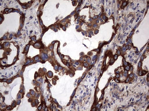 KRT7 / CK7 / Cytokeratin 7 Antibody (clone OTI2A2)