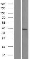 Human Aprataxin / APTX Protein (Over-Expression Lysate Myc-DDK (Flag))