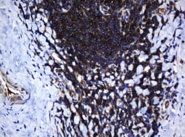 DEF6 Antibody (clone OTI1D1)