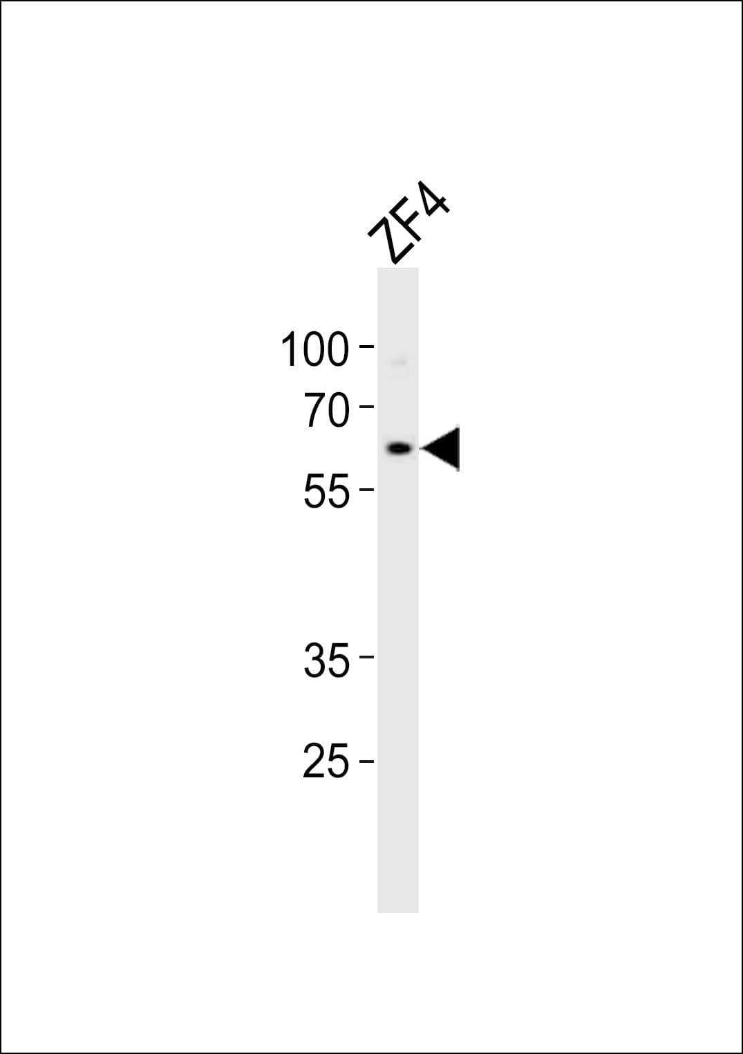 CAMK2D / CaMKII Delta Antibody (aa221-250)