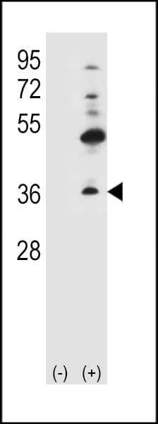 GJB4 / CX30.3 / Connexin 30.3 Antibody (aa90-120)