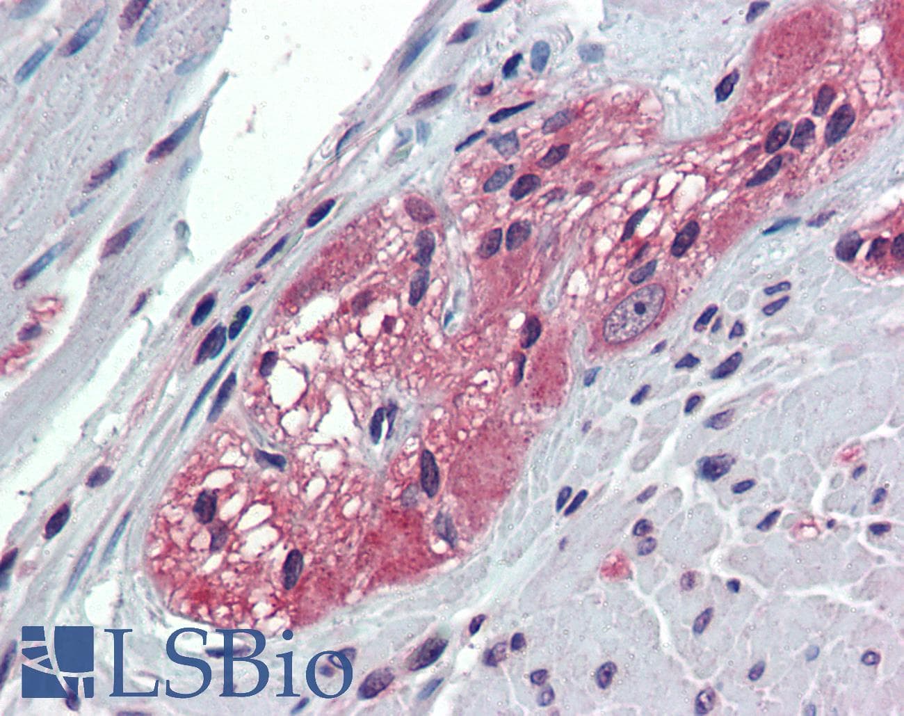 IHC-plus™ TXLNB Antibody (Internal)